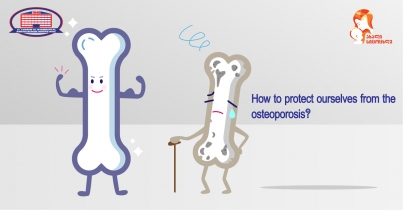 Osteoporosis – How to protect ourselves from Osteoporosis?