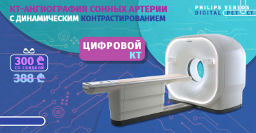КТ-ангиография сонных артерий с динамическим контрастированием
