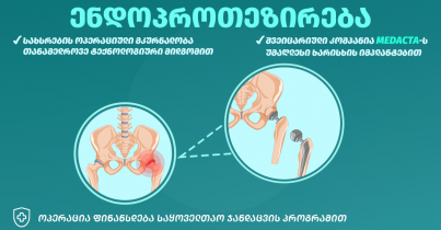 მენჯ-ბარძაყის და მუხლის სახსრის ენდოპროთეზირება შვეიცარული იმპლანტებით