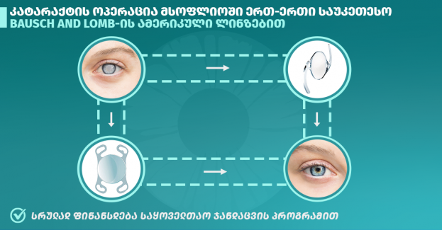 კატარაქტის მკურნალობა ქირურგიის ეროვნულ ცენტრში