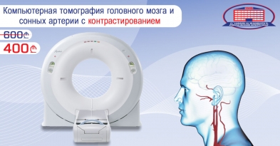 ПРОВЕДИТЕ КОМПЬЮТЕРНУЮ ТОМОГРАФИЮ МАГИСТРАЛЬНЫХ СОСУДОВ ГОЛОВНОГО МОЗГА И КАРОТИДНЫХ (СОННЫХ) АРТЕРИИ С КОНТРАСТИРОВАНИЕМ! 