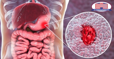Весной происходит обострение язвенной болезни желудочно-кишечного тракта - Национальный Центр Хирургии предлагает золотой стандарт лечения!