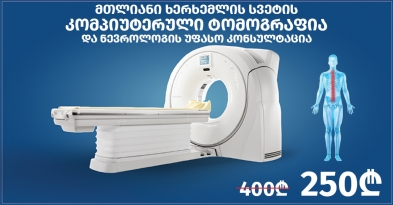 მთლიანი ხერხემლის სვეტის კომპიუტერული ტომოგრაფია და ნევროლოგის კონსულტაცია