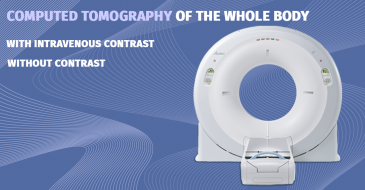 Computed tomography of the whole body 