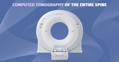 Computed Tomography Of The Entire Spine