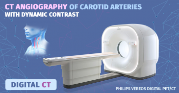 Carotid Artery CT Angiography With Dynamic Contrast