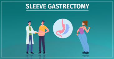 Stomach reduction surgery - lose excess weight from the first day of laparoscopic surgery