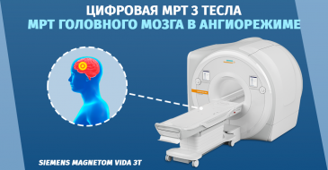 МРТ исследование головного мозга с ангиографией