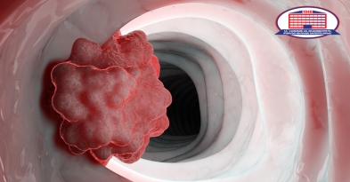 Health Condition of Patients with Duodenal Leiomyosarcoma Has Improved Using a Chemotherapy at The National Center of Surgery