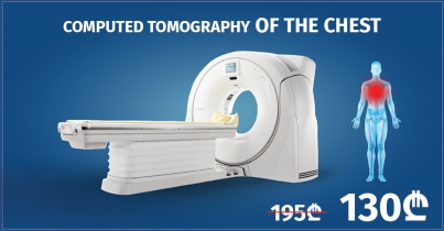 CT Of The Chest In Batumi Clinic