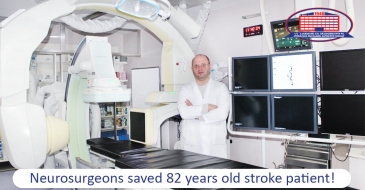 Neurosurgeons saved 82 years old stroke patient! Pathological blood vessel that only 3 people out of 1 million have
