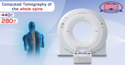Computed Tomography Of The Entire Spine