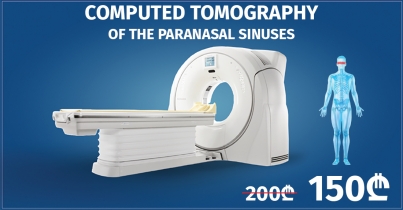 Computed Tomography Of The Paranasal Sinuses In The Batumi Clinic