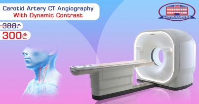 Carotid Artery CT Angiography With Dynamic Contrast