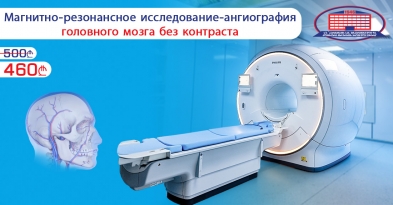 Исследование головного мозга- ангиография, без контраста