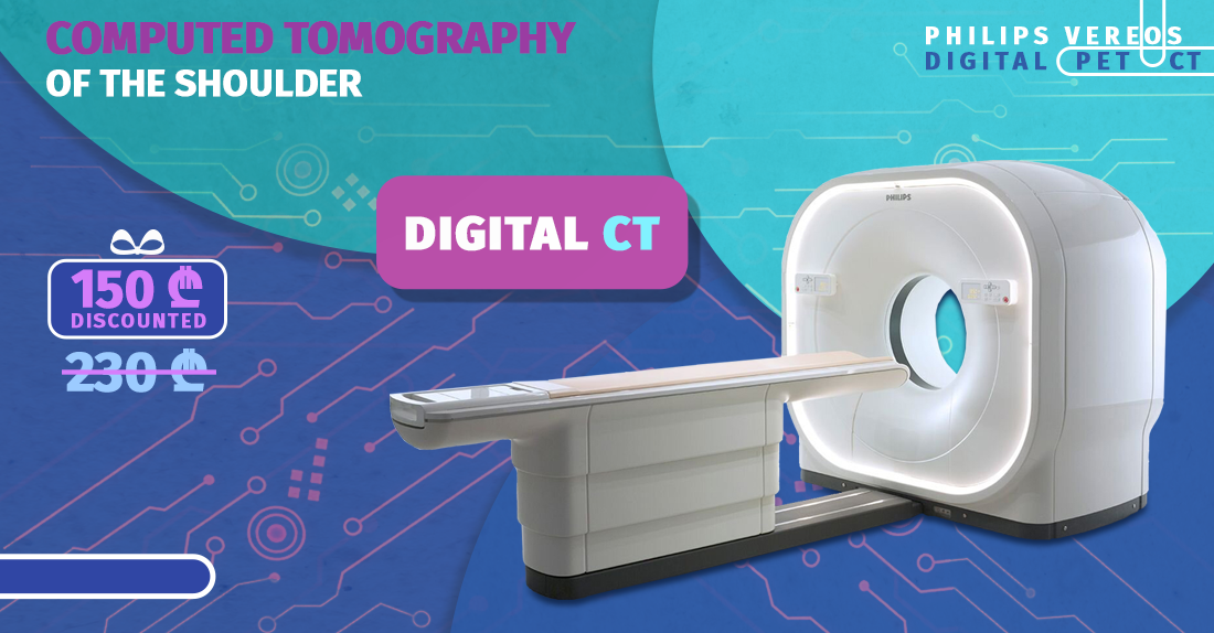 Computed tomography of the paranasal sinuses