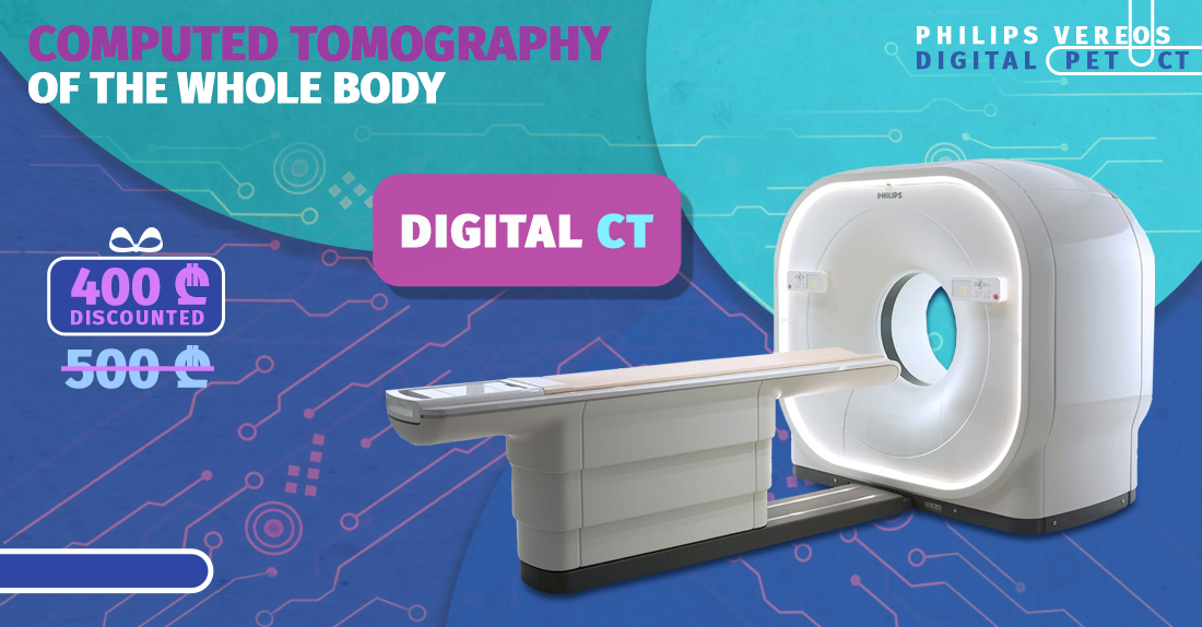 Only On Weekends - CT Examination Of The Whole Body For 400 GEL