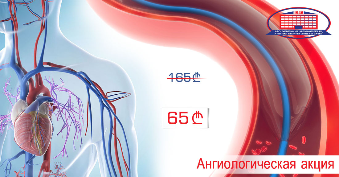 Ангиологическая акция