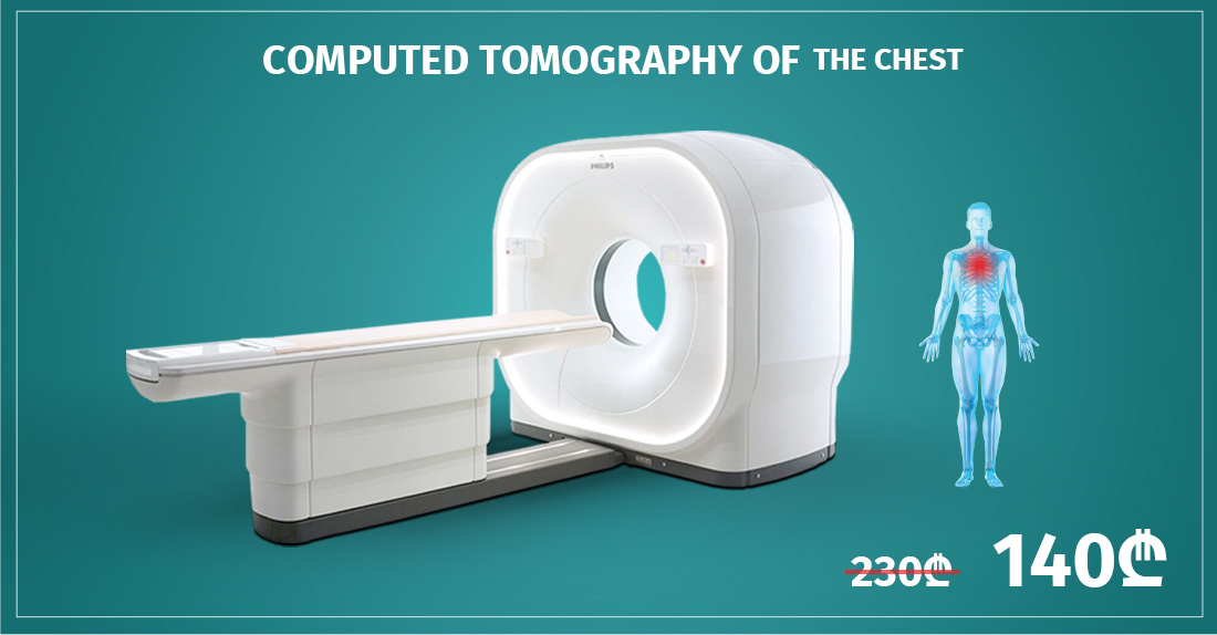 Weekend Discount On Chest Computed Tomography