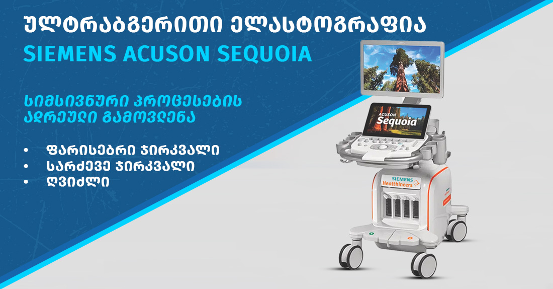 ულტრაბგერითი ელასტოგრაფია