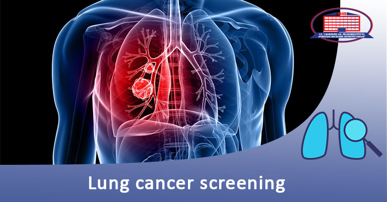 Lung cancer screening – We offer a computed tomography of lungs
