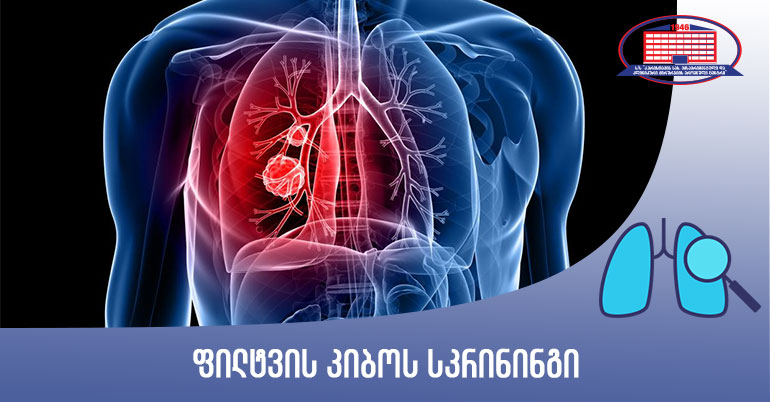 ფილტვის კიბოს სკრინინგი – გთავაზობთ ფილტვის კომპიუტერულ ტომოგრაფიას