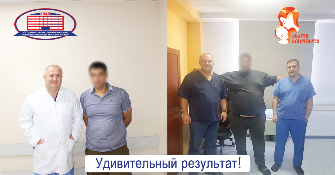 Операция на желудке с целью похудения - мужчина, который после СЛИВ-гастрэктомии за 11 месяцев похудел на 100 килограммов