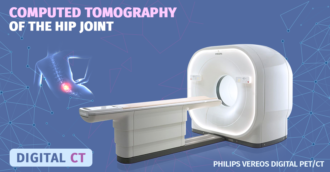 Computed Tomography Of The Lumbar Joint