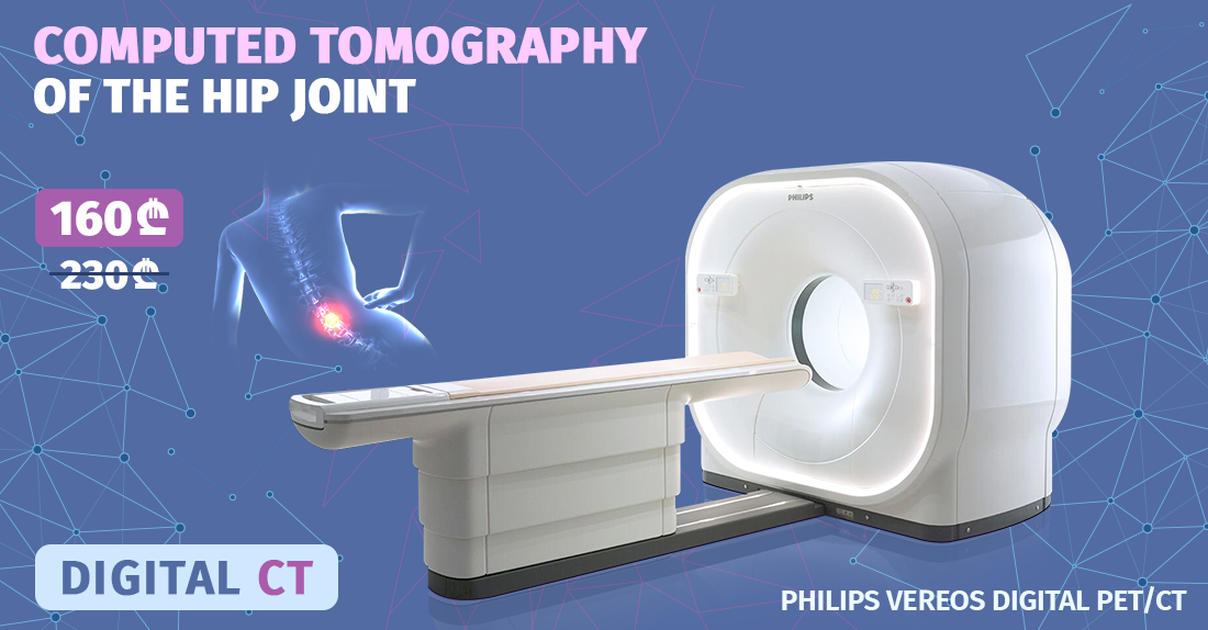 Computed Tomography Of The Lumbar Joint