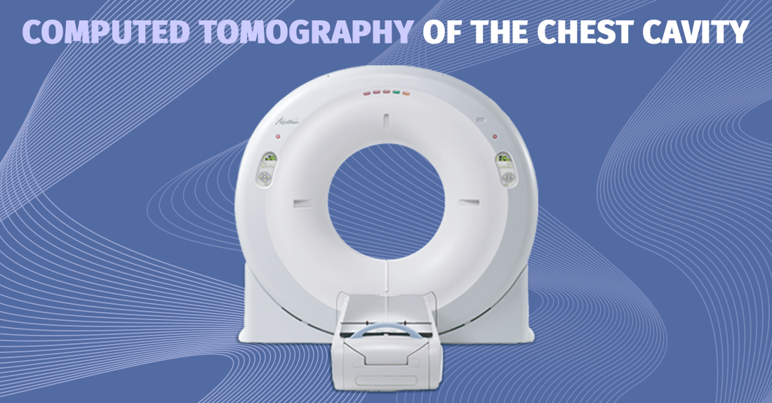  Chest (lungs, bronchus, esophagus, thoracic vertebrae, breast) computed tomography