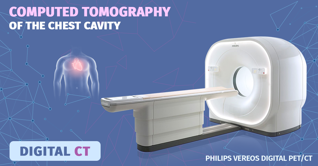 Computed Tomography of the chest!