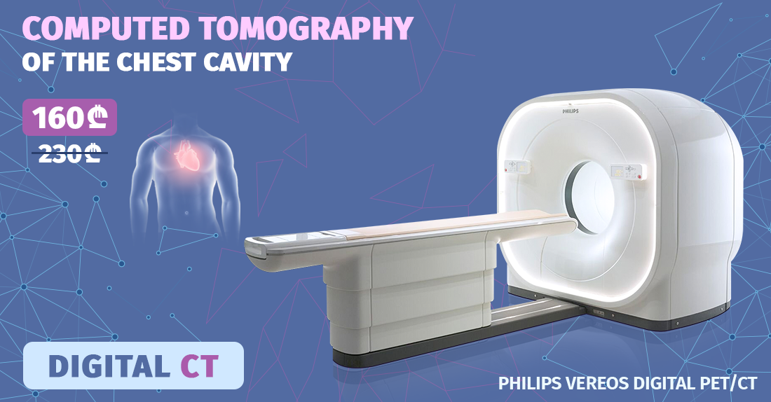 For Only 160 GEL - Computed Tomography of the chest!