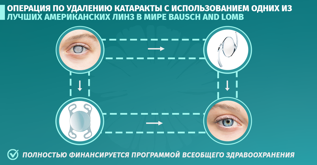 Лечение катаракты в Национальном Центре Хирургии