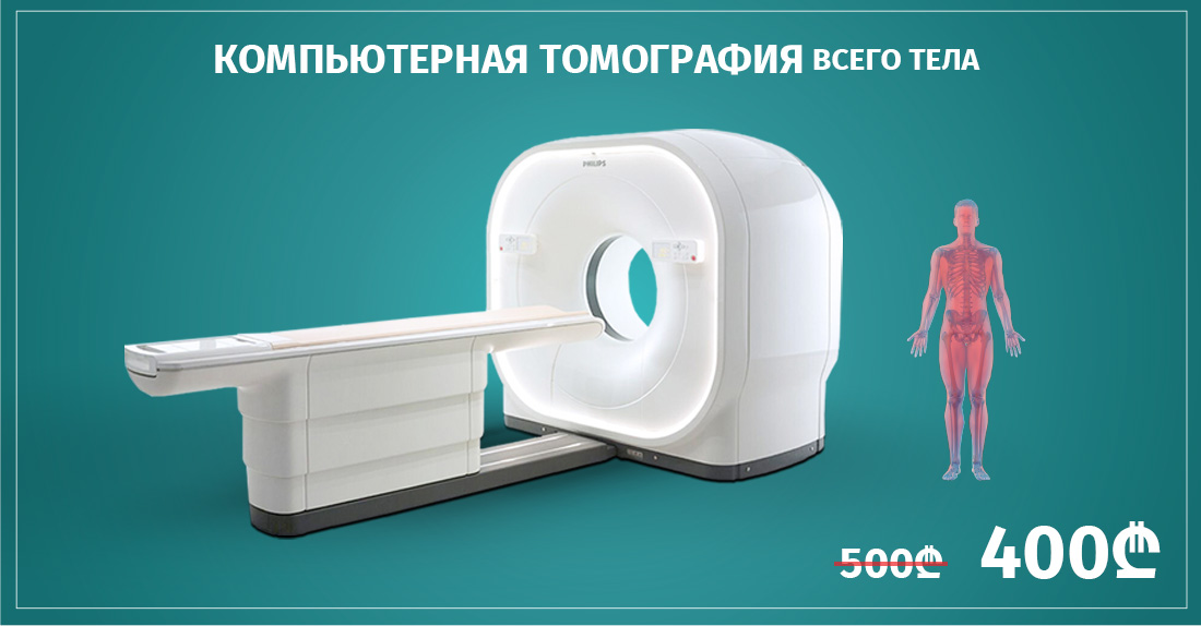 Только по выходным - КТ исследование всего тела за 400 лари