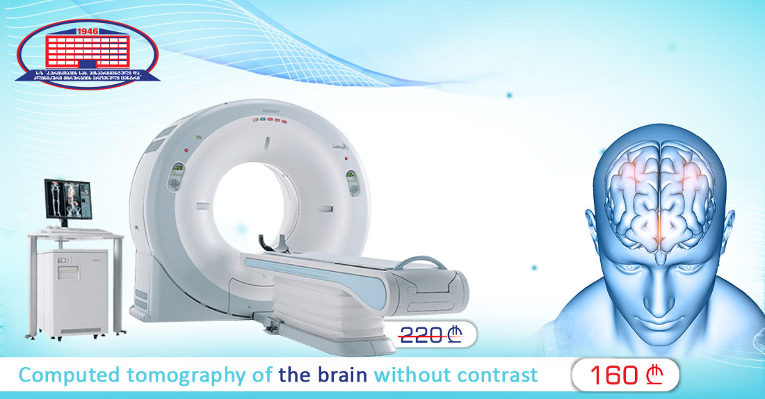 Get Rid of Headaches – We offer Computed Tomography of the Brain and Neurologist Consultation
