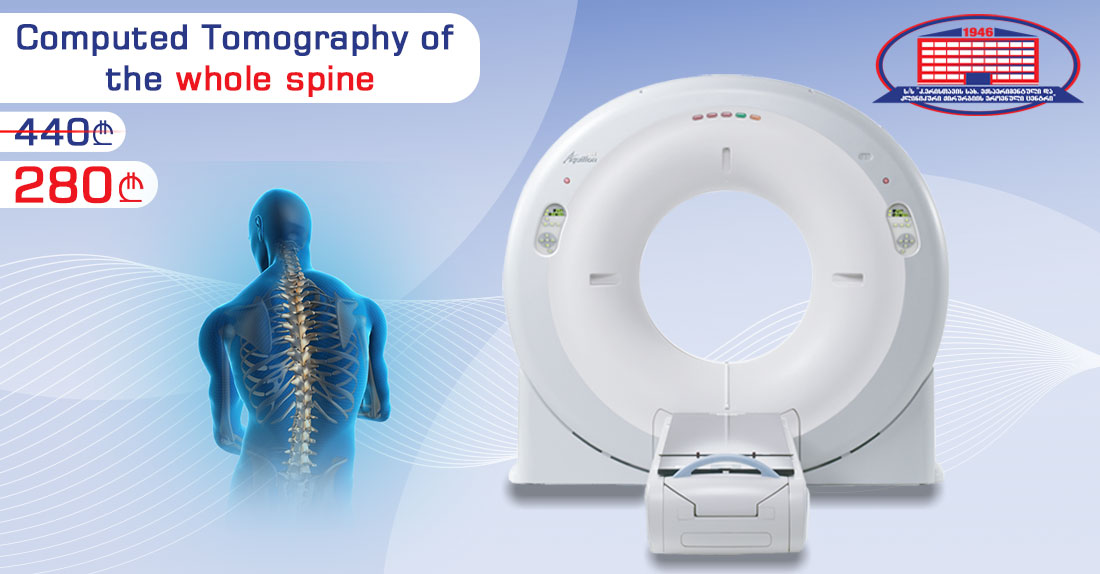 Computed Tomography Of The Entire Spine