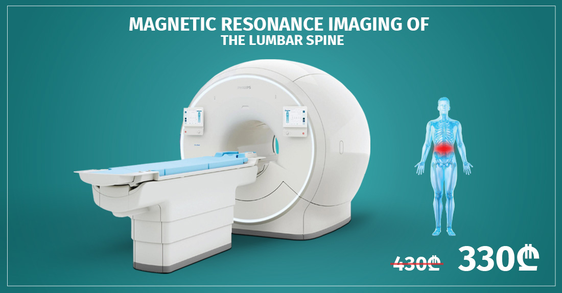 Magnetic Resonance Imaging Of The Lumbar Spine