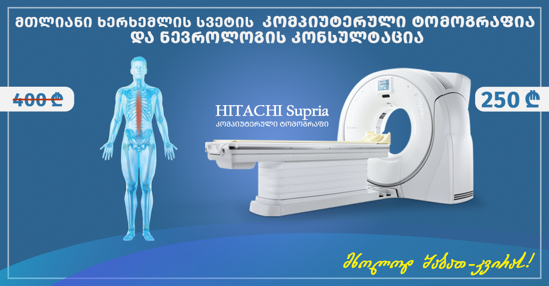 მთლიანი ხერხემლის სვეტის კომპიუტერული ტომოგრაფია და ნევროლოგის კონსულტაცია