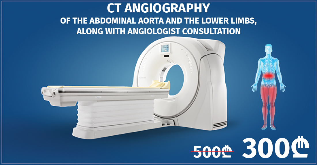 CT Angiography Of The Abdominal Aorta And The Lower Limbs, Along With Angiologist Consultation