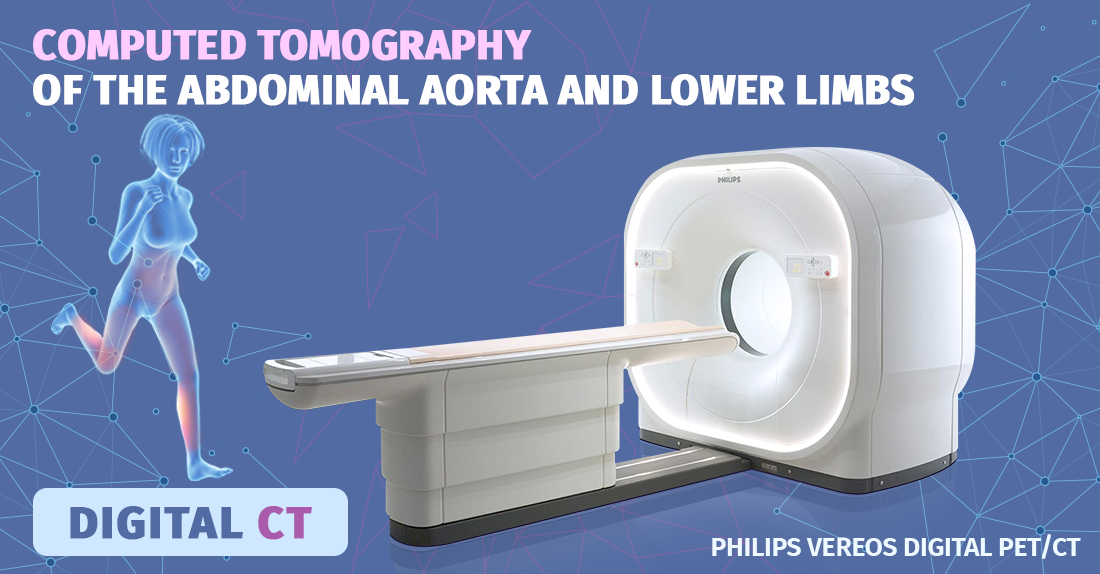 Computed Tomography Of The Abdominal Aorta And Lower Extremities
