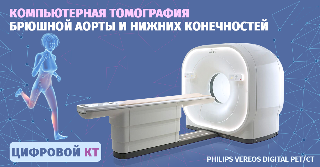 Компьютерная томография брюшной аорты и нижних конечностей