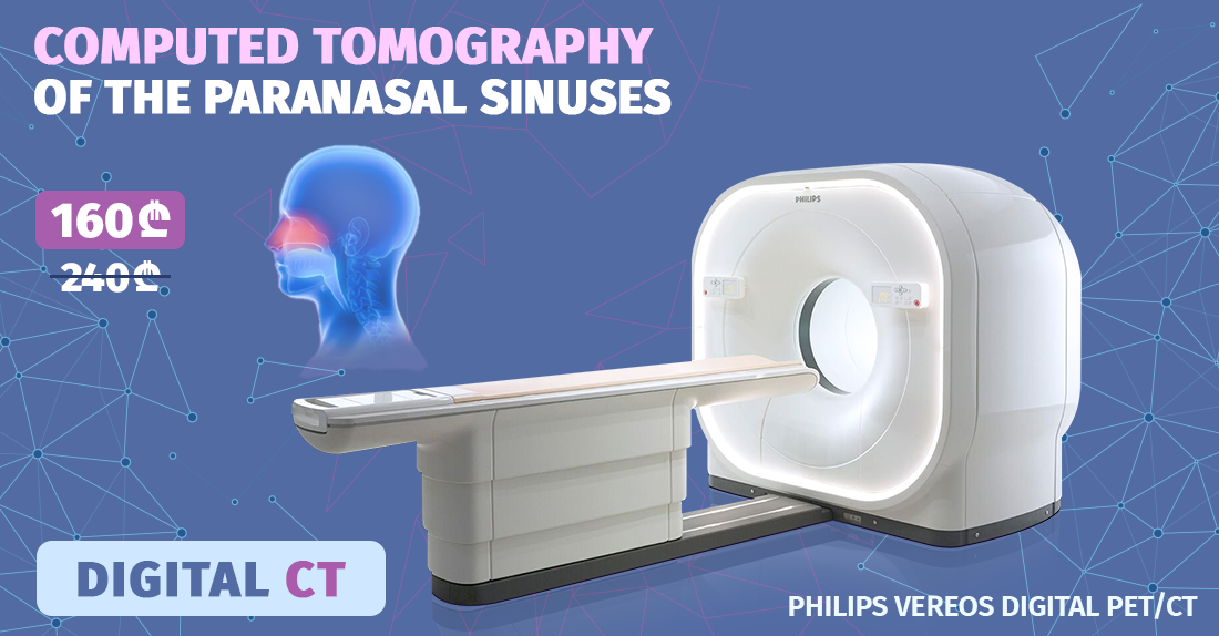 Computed tomography of the paranasal sinuses