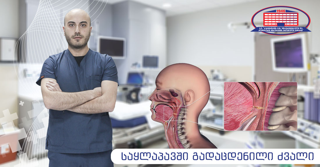 უცხო სხეულის გადაცდენა საყლაპავში