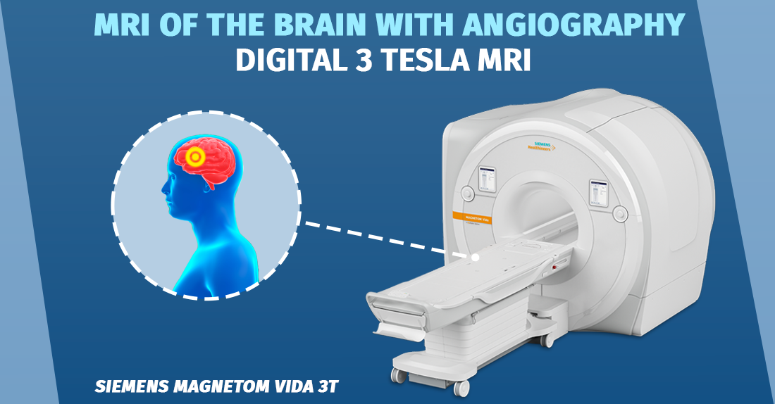 Brain MRI study with angiography 