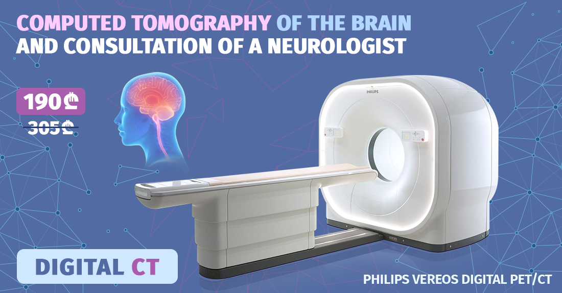 Computed Tomography Of The Brain And Consultation With A Neurologist