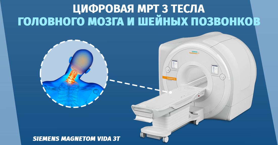 Магнитно-резонансная томография головного мозга и шейных позвонков