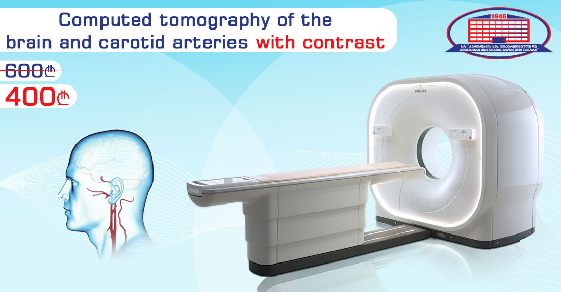 CT Study Of The Main Blood Vessels Of The Brain And Carotid (Internal) Arteries With Contrast