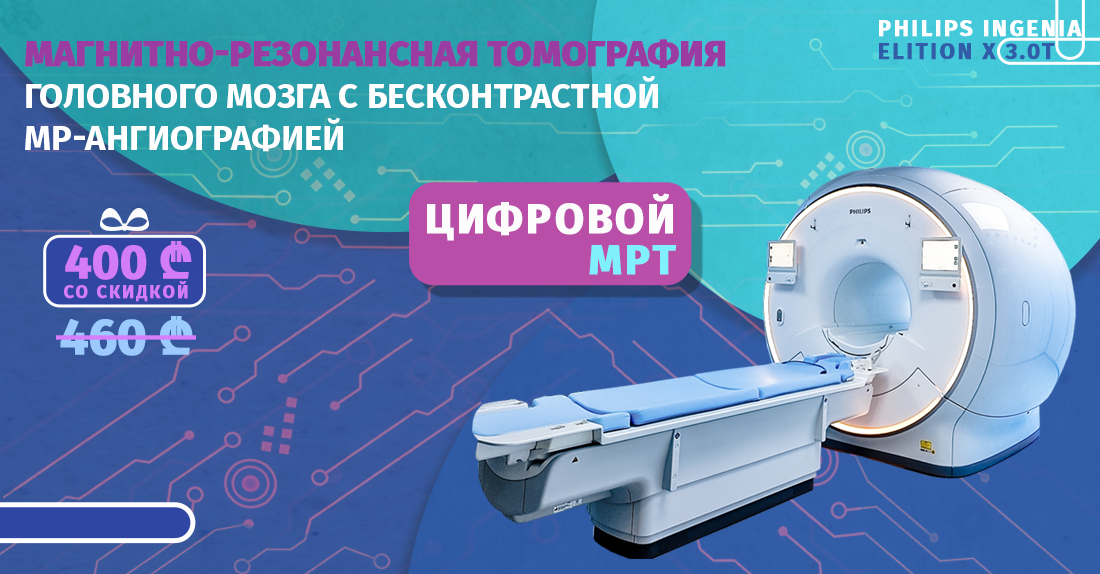 МРТ исследование головного мозга- ангиография, без контраста