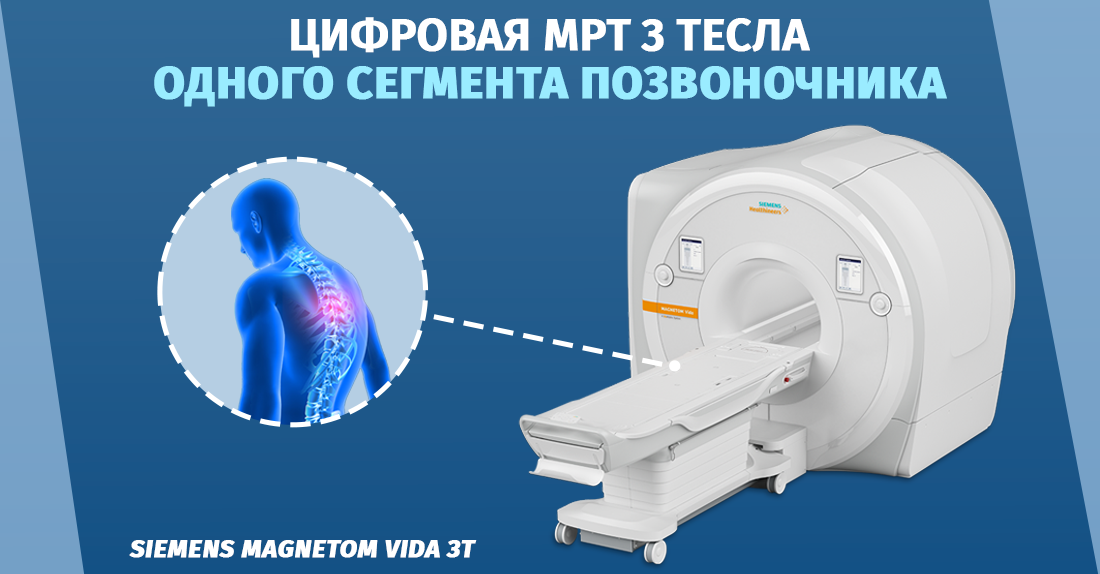 Магнитно-резонансная томография одного сегмента позвоночника  