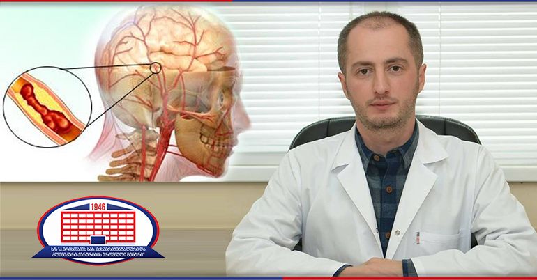 ქირურგიის ეროვნულ ცენტრში მწვავე იშემიური ინსულტის დროს წარმატებული შედეგით დასრულდა ჩატარებული თრომბოლიზური თერაპია